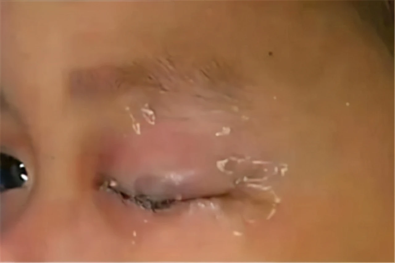 Hướng dẫn rửa mắt