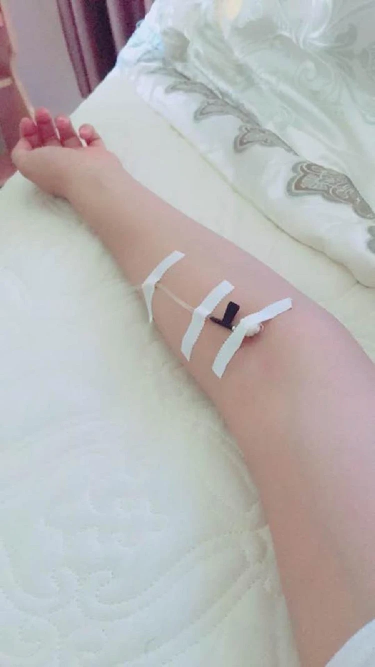 Hình ảnh truyền nước biển ở tay đẹp