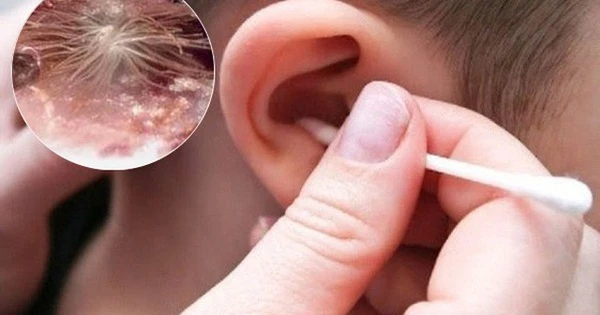 Ngứa tai phải ở nam giới