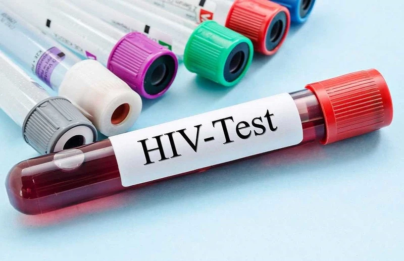 Quan hệ với người nhiễm HIV bao lâu thì bị nhiễm bệnh? Làm gì khi biết bạn tình bị HIV?