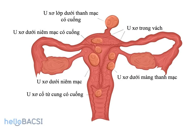 Top 10 lý do nữ giới bị đau khi quan hệ tình dục