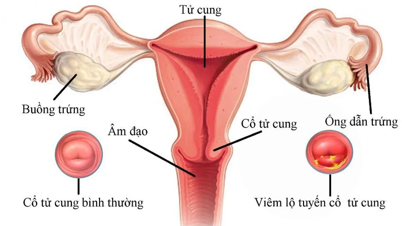 Lâu ngày không quan hệ vùng kín có khít lại không?