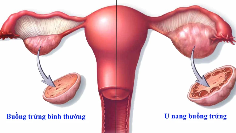 Quan hệ xong đau bụng dưới có thai không? [Chuyên gia giải đáp]