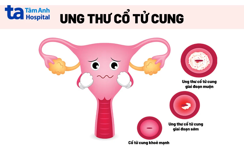 Quan hệ ra máu đỏ tươi có thai không? Nguyên nhân và cách xử trí