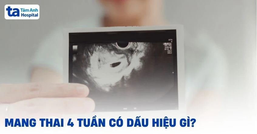 Mang thai 4 tuần có dấu hiệu gì? 11 triệu chứng thường gặp