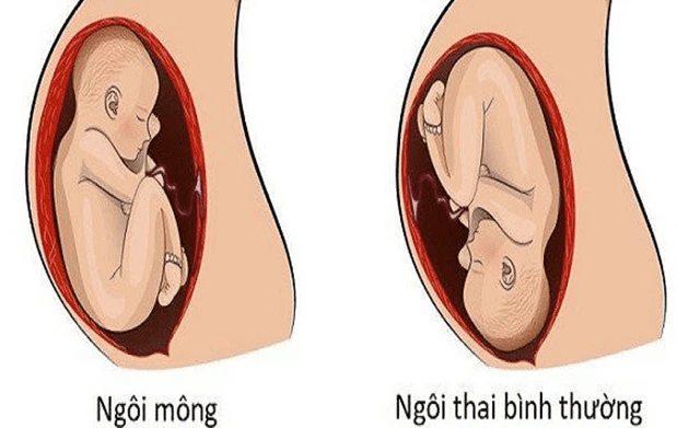 Siêu âm thai và 3 mốc siêu âm quan trọng mẹ bầu cần lưu ý