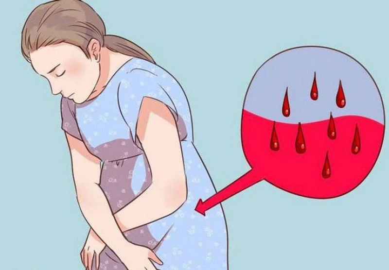 Tình trạng ra khí hư màu hồng nhạt có nguy hiểm không?