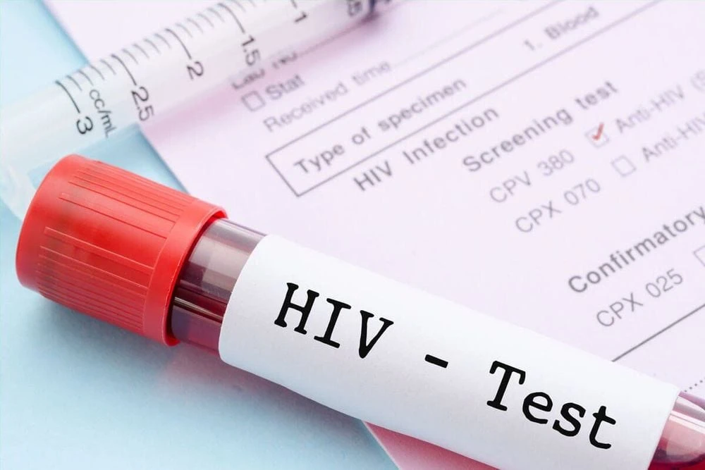 Làm gì nếu nghi ngờ nhiễm HIV sau quan hệ tình dục?