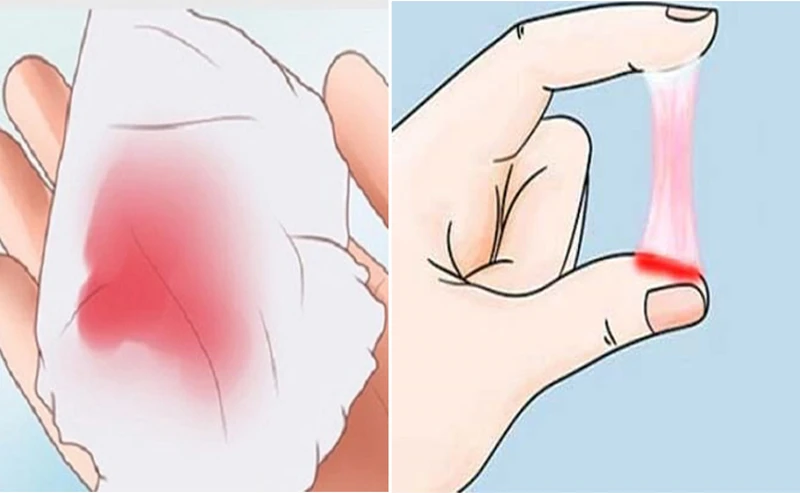 Tình trạng ra khí hư màu hồng nhạt có nguy hiểm không?