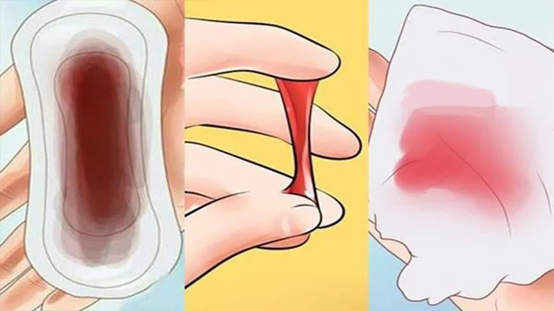 Tình trạng ra khí hư màu hồng nhạt có nguy hiểm không?