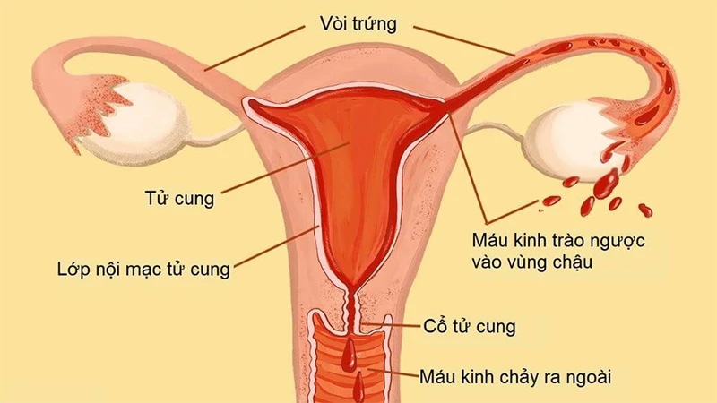 Niêm mạc có kiêng quan hệ không? Tìm hiểu chi tiết