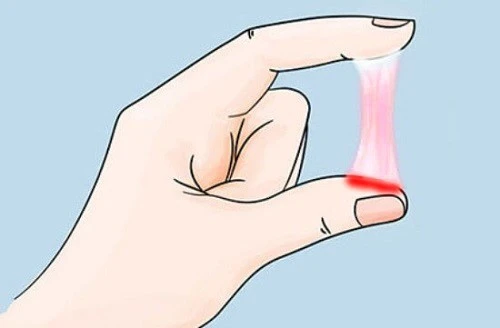 99+ Hình ảnh quần lót nữ dính khí hư