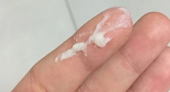 99+ Hình ảnh quần lót nữ dính khí hư